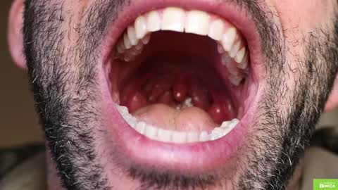 Crazy Ignites online show from February 6, 4:14 pm